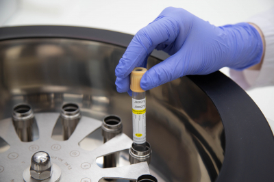 Эксперт Варивода назвал пять ключевых показателей в анализе крови